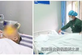 怪事！6旬老人全身发红皮肤瘙痒脱屑，背后原因万万想不到视频封面