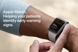 国行Apple Watch的心电图获批了，但功能恐怕没那么强大图片