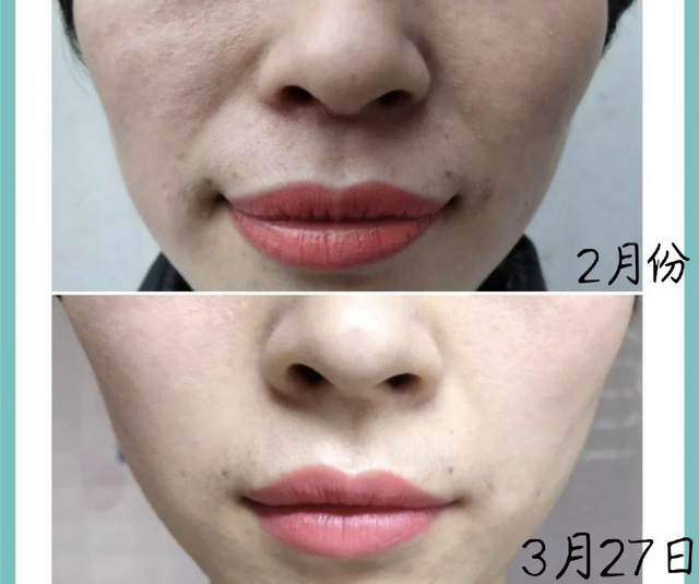 女人长期喝胶原蛋白好吗 2025年女人长期喝胶原蛋白好吗有效果吗