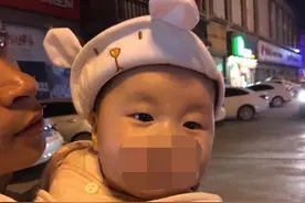 为啥有的孩子18岁才长出“双眼皮”？3原因是关键，你娃中招没？图片