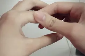 每天早上双手发胀，五指握不拢，但过一会又好了，是怎么回事？图片