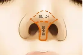 常见的鼻小柱几种问题与改善方法图片