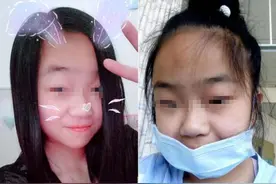 这5种孩子会越长越丑，医生直言：与其等他们长开，不如自己想开图片