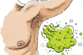 一抬手就闻到腋下的狐臭味？医生分享5个方法，“根除”狐臭图片