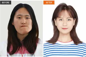 “歪脸女孩”赵宏秋，不当网红当老师，网友：这才是整形的真谛图片