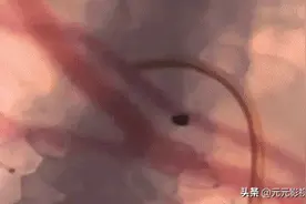一张图带你了解蚊子的吸血过程，直接插血管图片