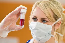 思想很“开放”的日本人，为什么很少患艾滋病？图片