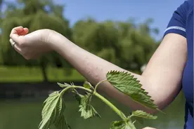 荨麻疹的祸根找到了，提醒：7类食物要注意忌口，以免病情反复图片