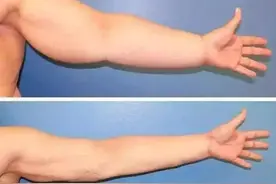 告别拜拜肉 拥有美丽手臂 这一篇就够了图片