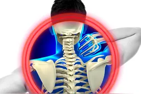 脖子酸痛？教你三种锻炼颈部肌肉的运动图片