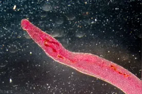 梅毒、淋病、尖锐湿疣、艾滋病，这些性病是怎么诞生和传播的？图片