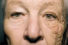 暴晒后又黑又丑该如何拯救？｜晒后修复指南：美白、抗老一招搞定图片