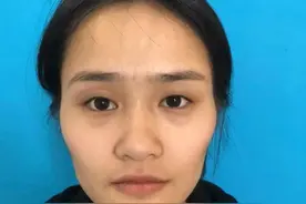总被说“显老”，却又找不到原因？面部凹陷、颧骨外扩看你有没有图片