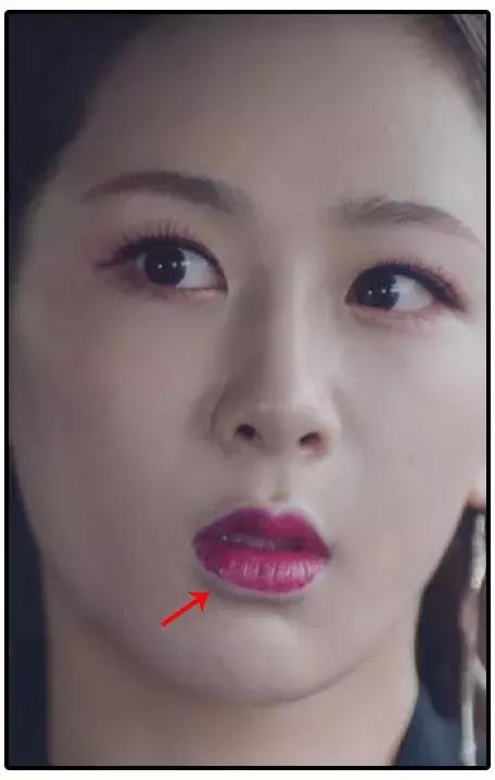 婴儿唇珠掉皮怎么办