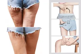 按摩要有重点！轻松歼灭手、腹、臀、腿的难看橘皮，还你漂亮美体图片