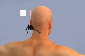 3D演示：脊椎间盘突出手术，从脖子打孔，痛死了