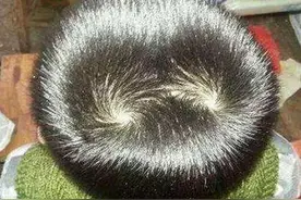 宝宝的“头旋”方向决定智商天赋？原来是这样，父母别不知道图片