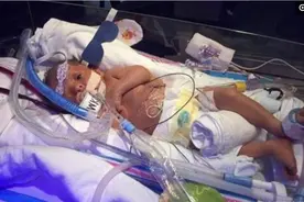 双胞胎哥哥在弟弟离世前紧紧抱住他，看了让人心酸图片