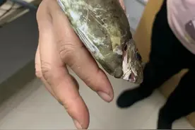 北海一妇女被泥猛鱼鱼鳍刺中右手大拇指“无法自拔”图片