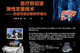 【影像科普】肝脏硬不硬？肝脏新侦探——超声弹性成像给您答案图片