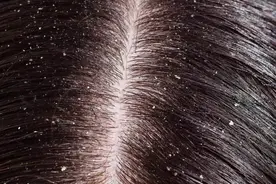 2块钱一款的硫磺皂原来这么好用图片