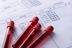 火爆癌友圈的CTC检查，真有这么神奇？图片