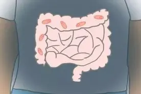 如果一个人的肠子缝上，能活多久？图片