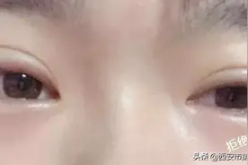 #安心变美课堂##我的安心变美推荐# 眼皮越来越松，怎么办？图片