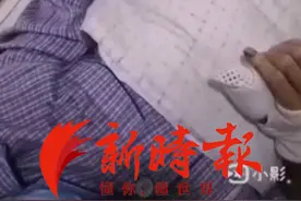 济南“两双手”火爆网络：看见农民工大爷双手皲裂，护士小姐姐亲手为他涂护手霜图片