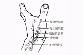 我只是手腕痛，怎么会得鼠标手呢？图片