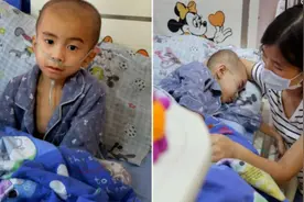 28岁母亲曾亲手拔掉头胎的氧气管，如今二胎依旧患重病走投无路图片