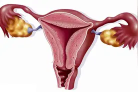 因为生孩子被切除子宫，对女人意味着什么？敢考虑以后吗？图片