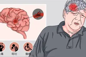 猝死的人提前一天做心电图能发现问题吗？图片