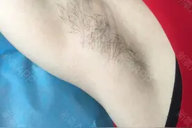 女生脱腋毛最好的方法有哪些？图片