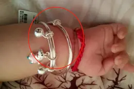 1岁宝宝银镯越来越亮，奶奶称“有福气”，体检时医生当场砸掉图片