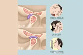 一张嘴“咔吧咔吧”响，脸还歪了，小心！你可能得了“ＴＭＤ”图片