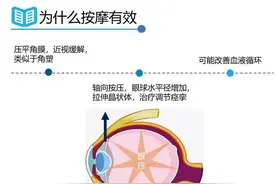 按摩等手段能提高视力，治疗近视吗？图片