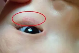 女儿频繁揉眼睛，父母带去医院检查，惊出一身冷汗！网友：真心大图片