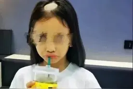 9岁小女孩养猫10天竟然导致“秃头”！小心被这些真菌感染图片