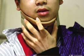 小伙10年不睡枕头，颈椎严重变形，医生教你如何挑对枕头图片