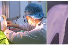 2岁男童老咳嗽，胸片检查找到“真凶”，医生提醒这个细节别忽视视频封面