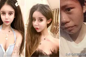 16岁网红少女成整容“常客”，3年动刀60多次，医生：脸都不要了图片