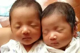 产妇一次诞下2个宝宝，丈夫还在高兴中，医生却说：这不是双胞胎图片