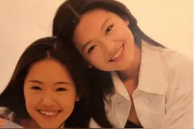 明星们做正畸，都用了哪种保持器？图片