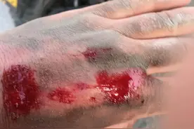 摩托湘西行和摔车经验图片