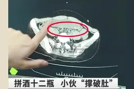 17岁男孩与朋友撸串豪饮12瓶啤酒，回家躺下就睡，醒来胃都要爆了图片