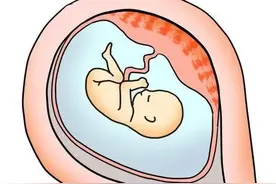 你的胎盘是“埋起来了”还是“吃下去了”？两种做法，结果大不同图片