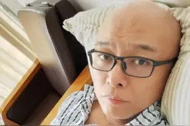 孟非住院近照曝光，脸色苍白无血色，网友：孟非这次真成孟爷爷了图片