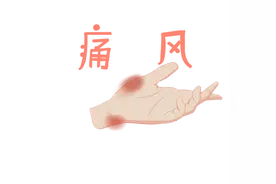 尿酸高怎么办？这样吃尿酸不升痛风不扰图片