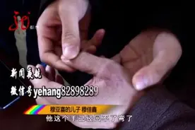 方向盘疯狂自转拉断司机手指韧带 4S店：我们借他2万图片